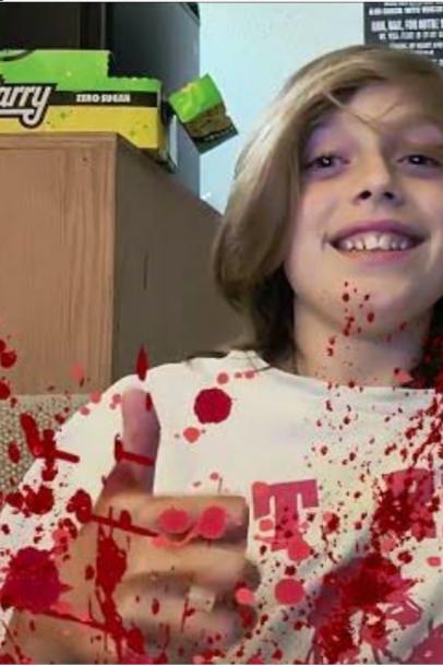 What to Do When You Stab Yourself with Scissors