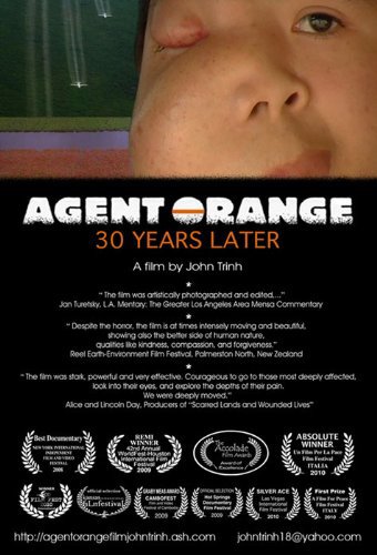 Agent Orange: 30 Years Later