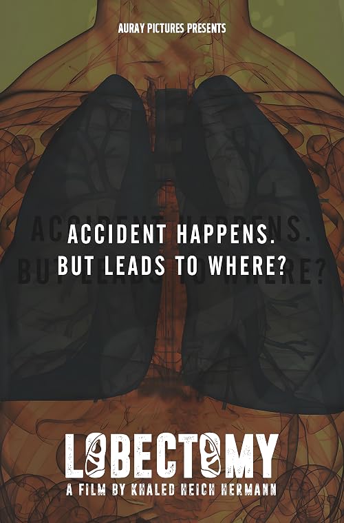 Lobectomy
