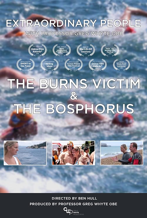 Extraordinary People - The Burns Victim and the Bosphorus
