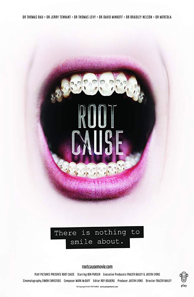 Root Cause - Die Wurzel allen Übels