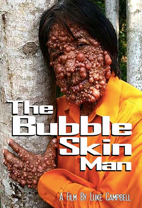 The Bubble Skin Man