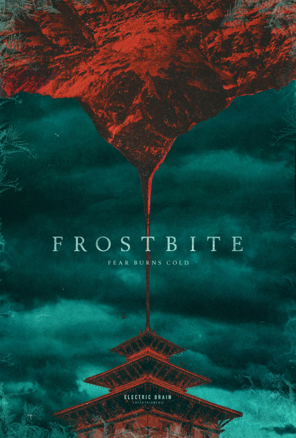Frostbite
