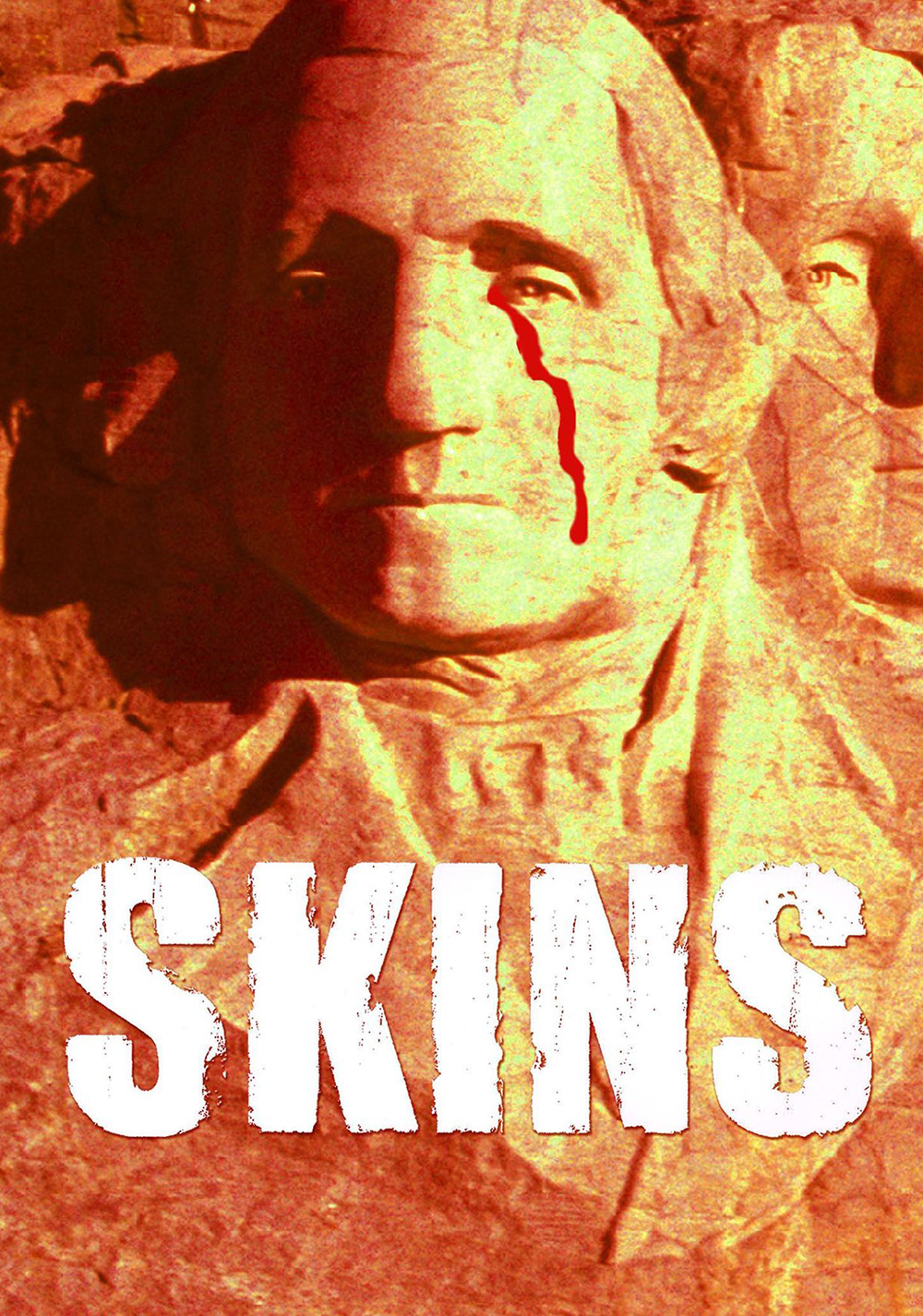 Skins