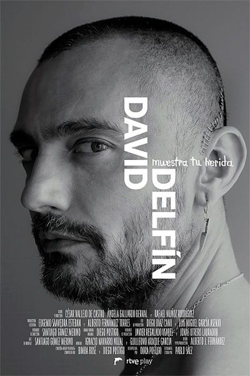 David Delfín. Muestra tu herida