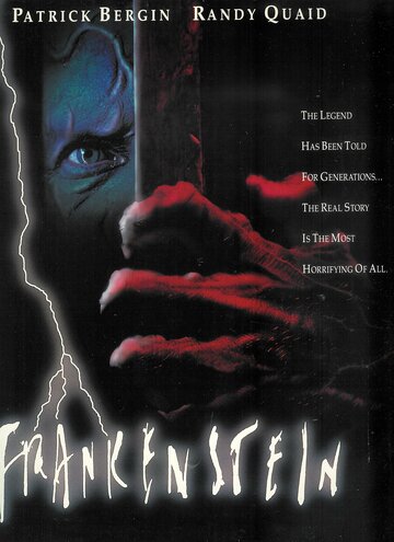 Dr. Frankenstein