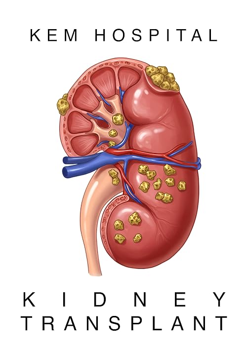 Kem Hospitals - Kidney Transplant