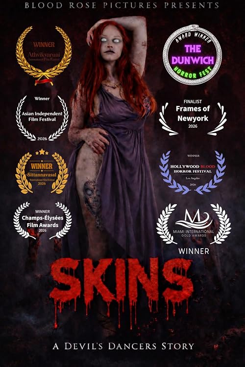 Skins