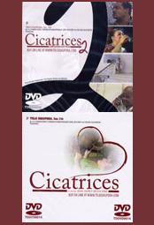 Cicatrices 2