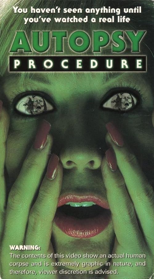 The Autopsy Procedure