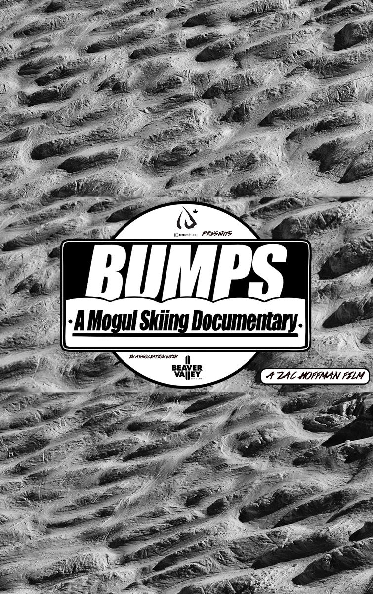 Bumps