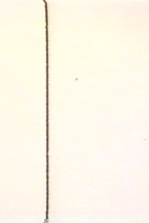 MA (Intervals)