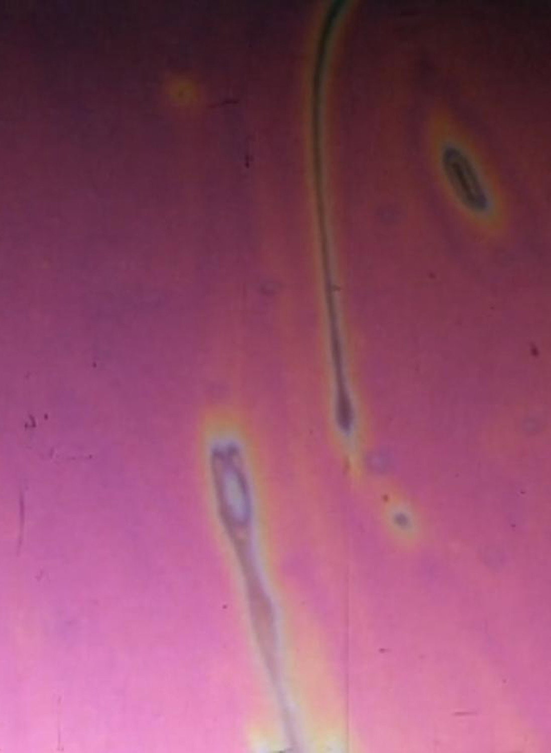 Komma