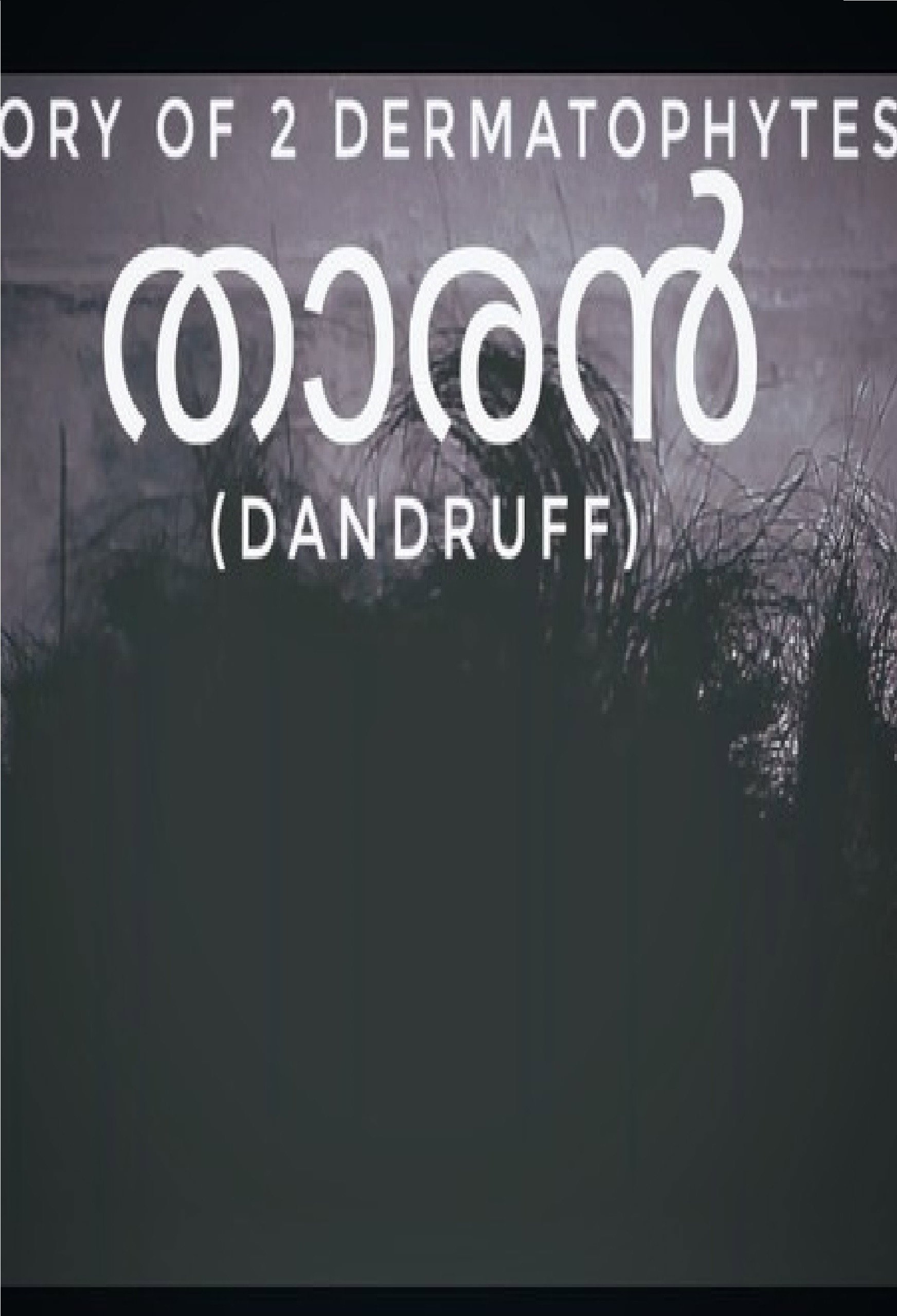 STORY OF 2 DERMATOPHYTES THARAN ( DANDRUFF)