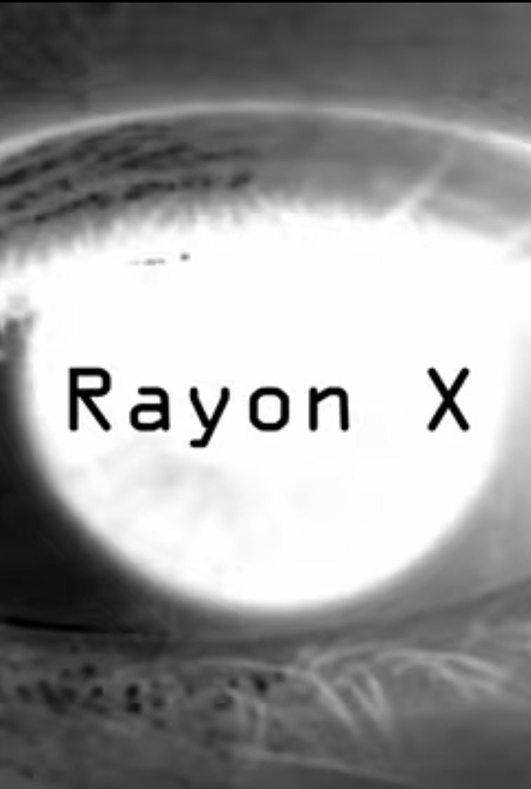 Rayon X