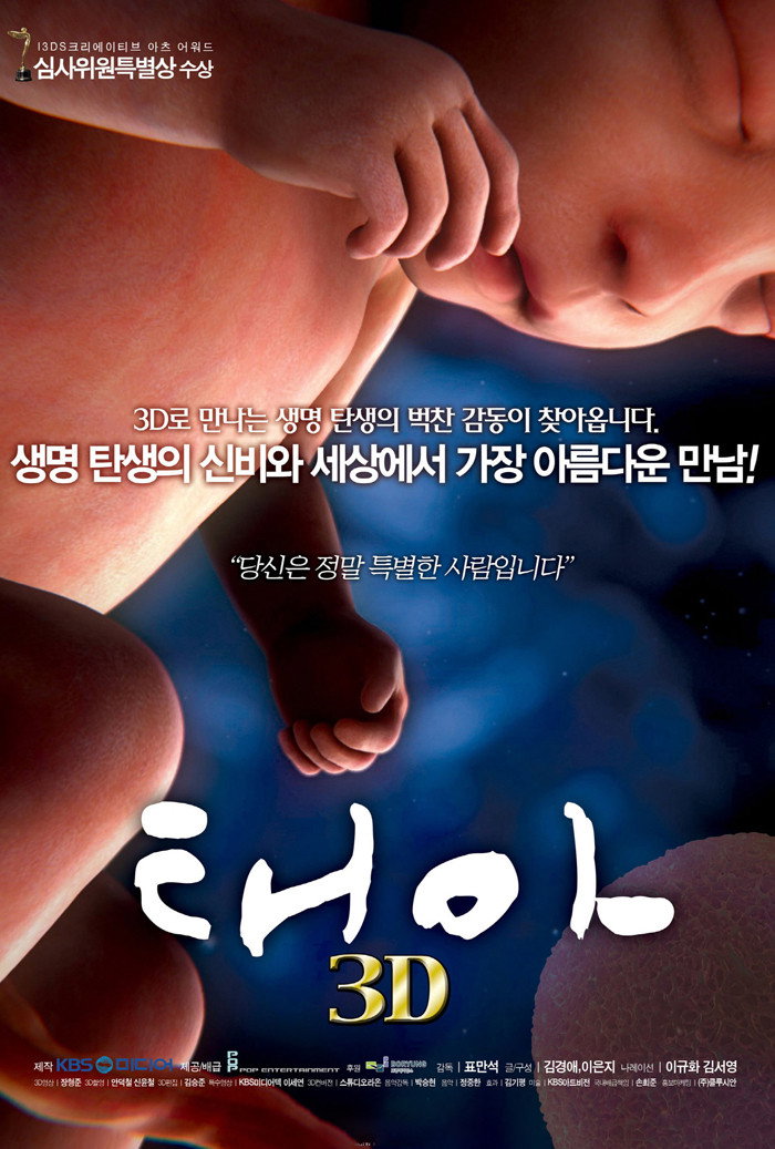 태아 3D
