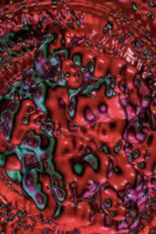 Cytolon