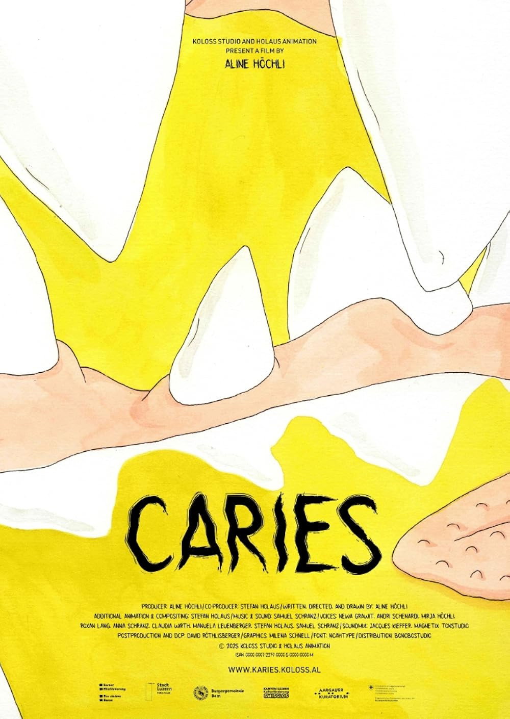 Karies