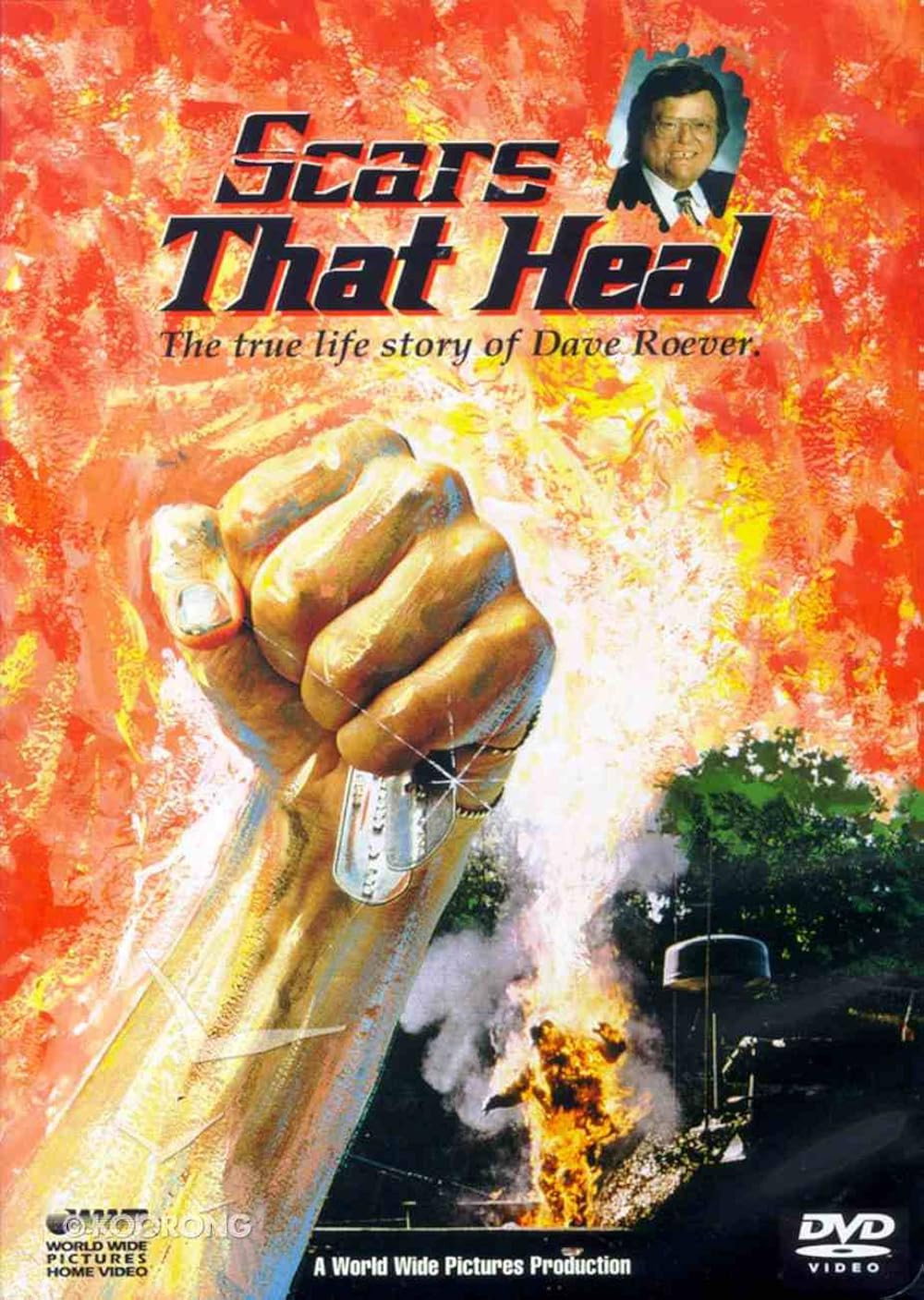 Scars That Heal: The Dave Roever Story