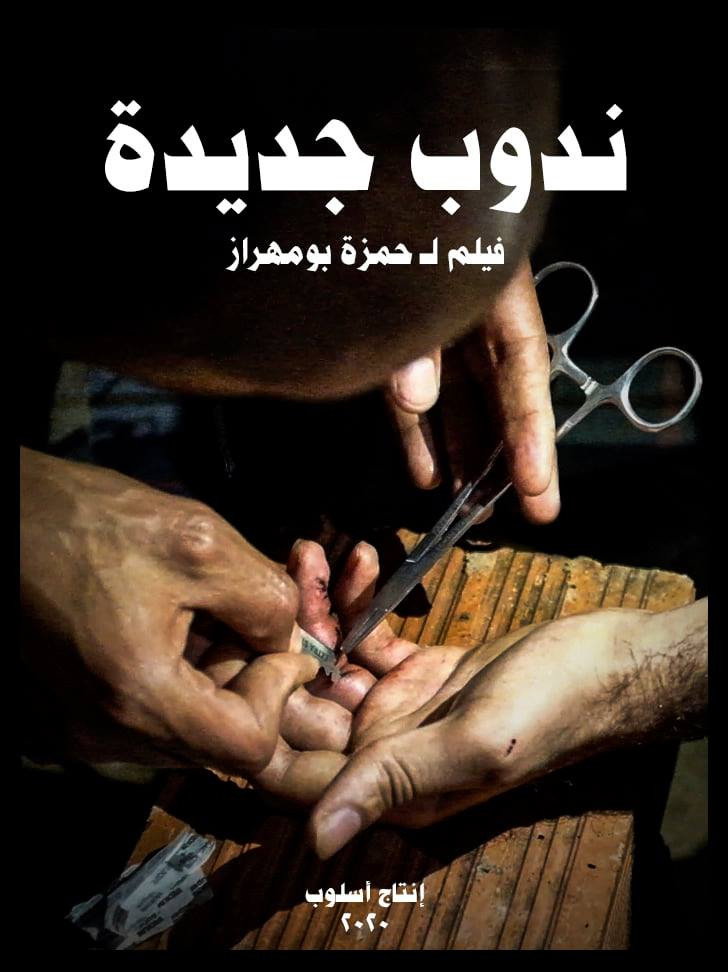 ندوب جديدة