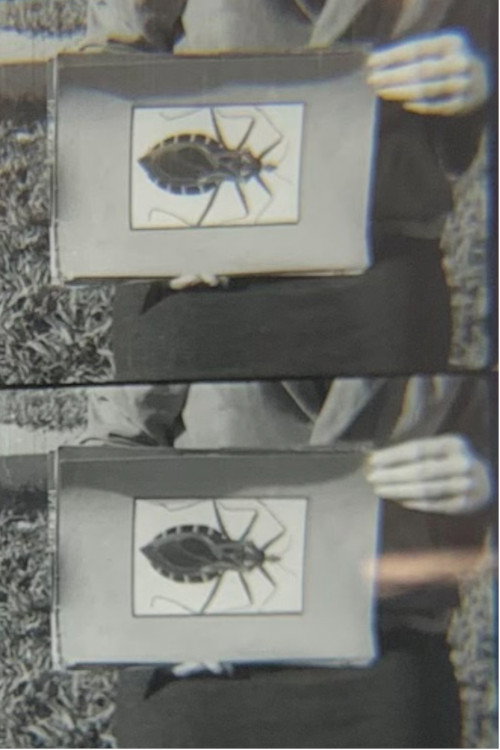 Doença de Chagas