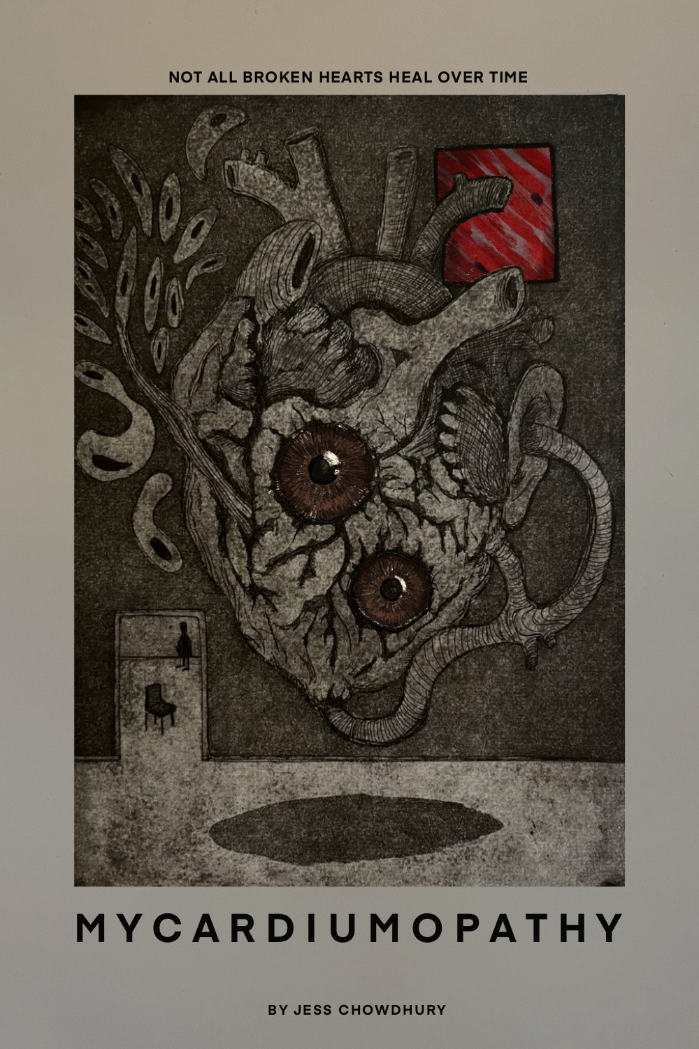 Mycardiumopathy