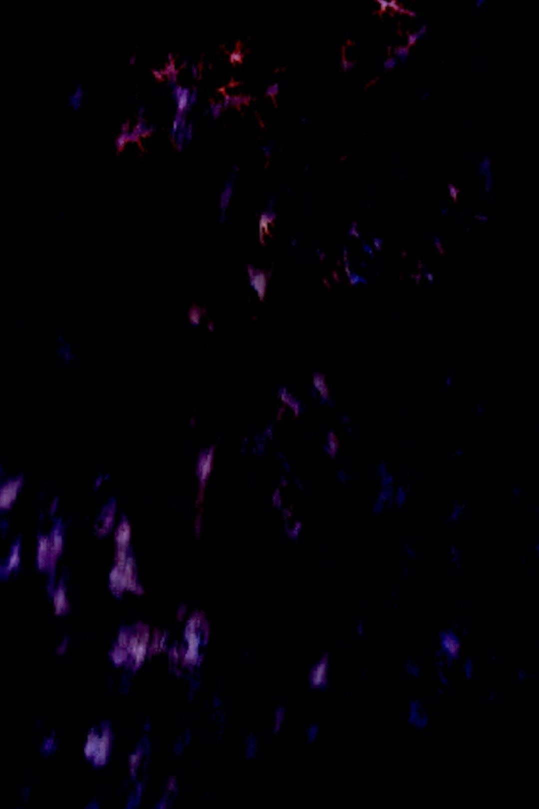 (Study II)