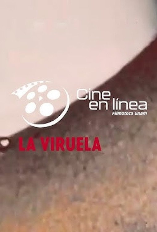 La viruela
