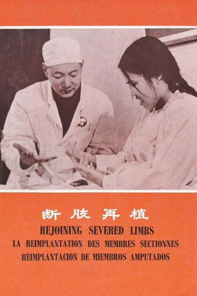 断肢再植