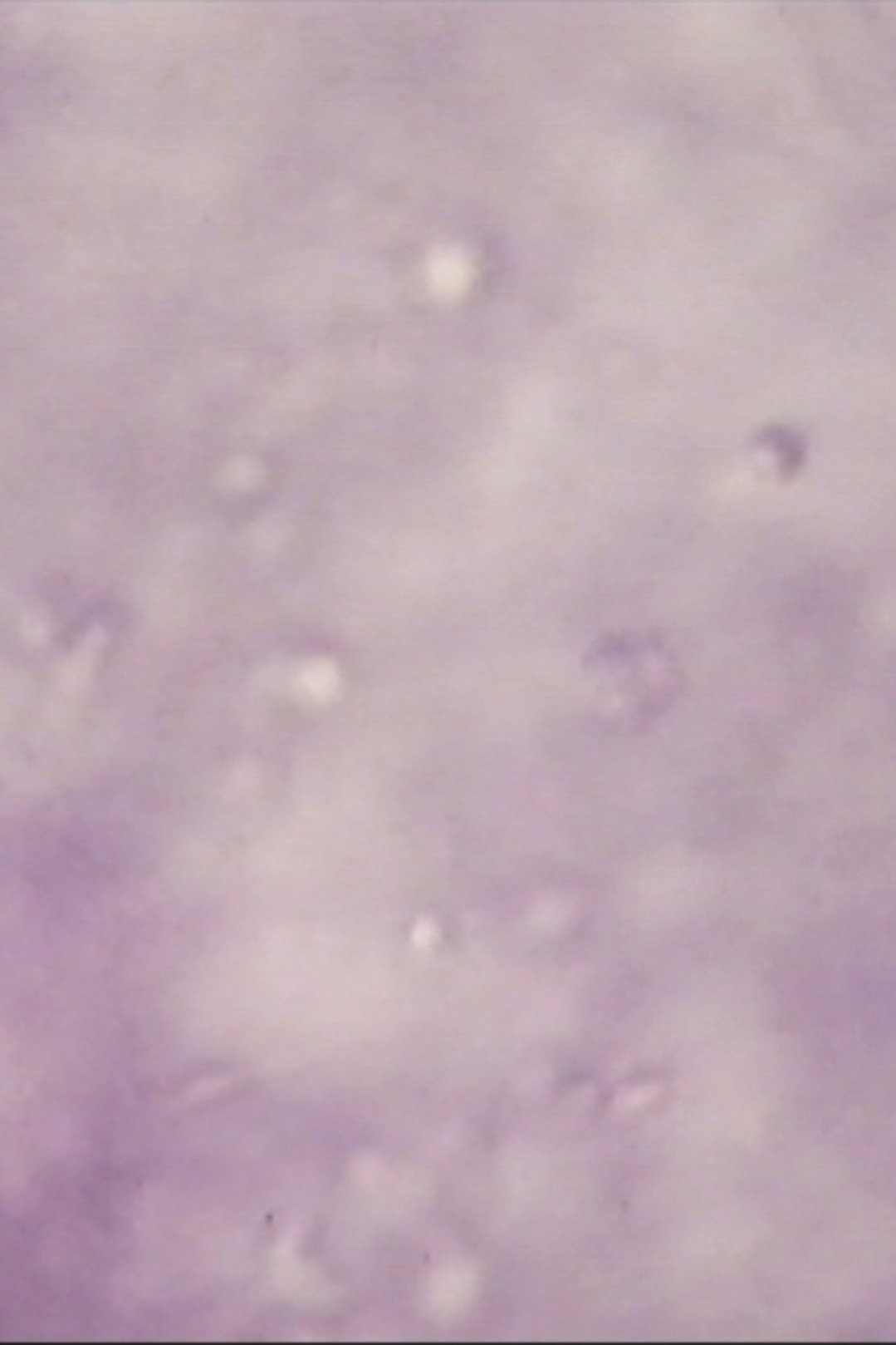 Sperm Sea