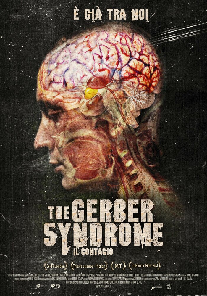 The Gerber Syndrome: il contagio