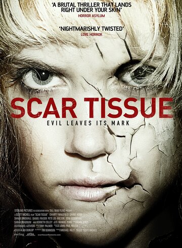 Scar Tissue