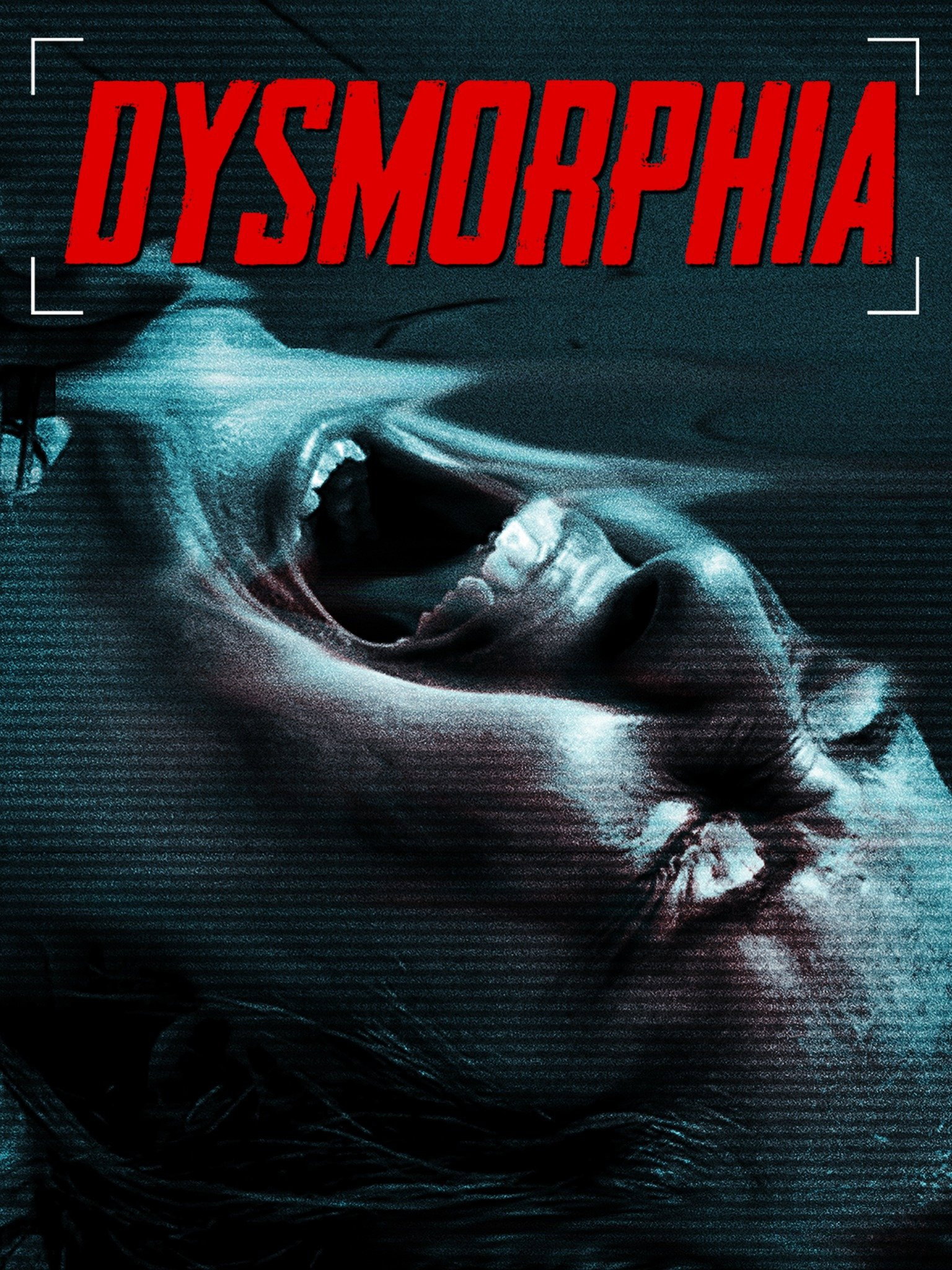 Dysmorphia