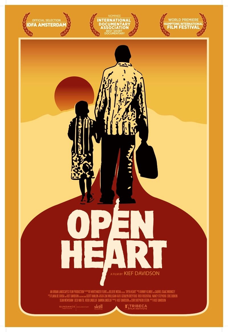 Open Heart