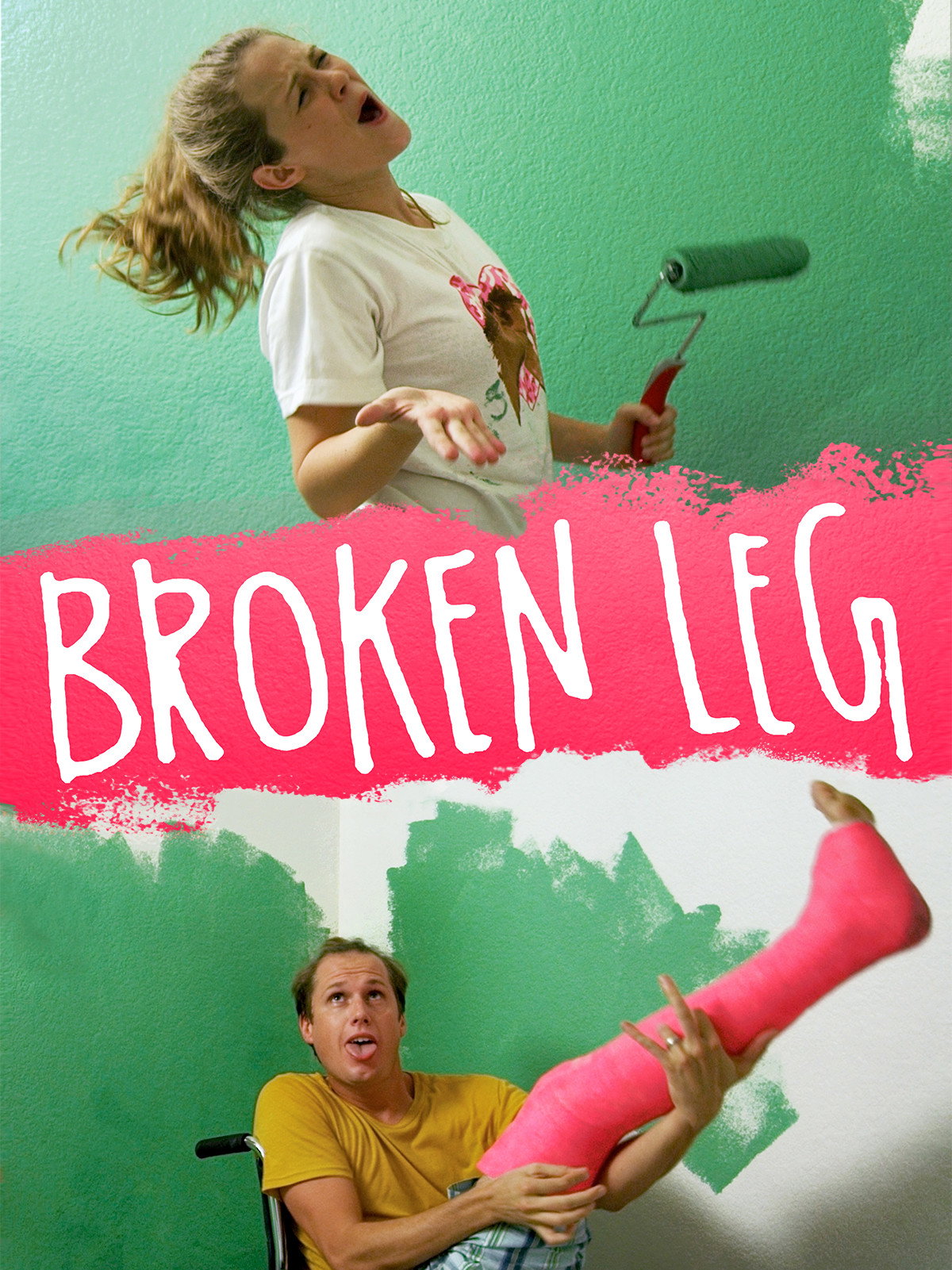 Broken Leg