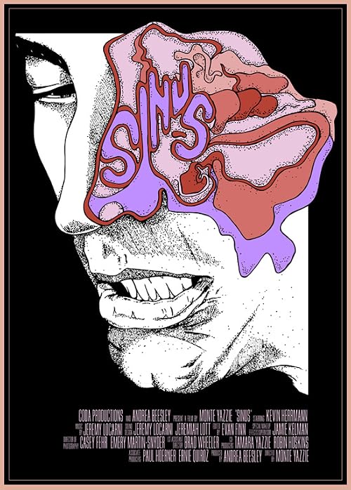Sinus