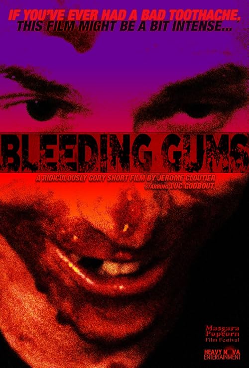 Bleeding Gums