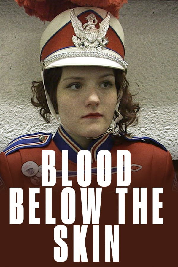 Blut unter der Haut