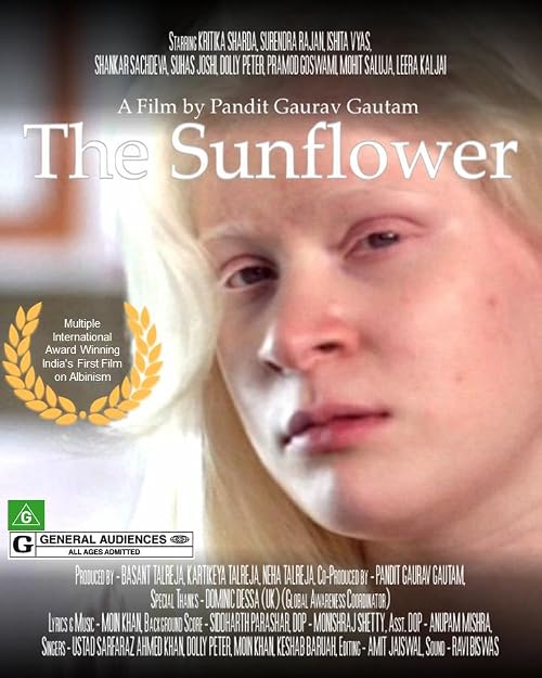 The Sunflower Albinism India