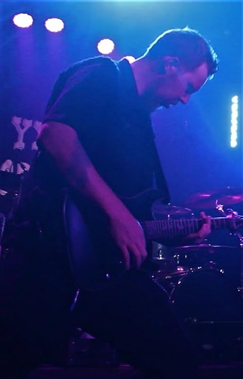 Fracture EPK