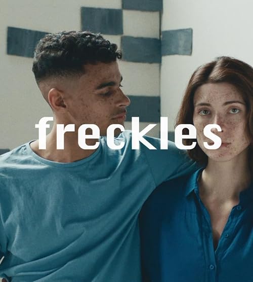 Freckles