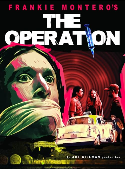 The Operation