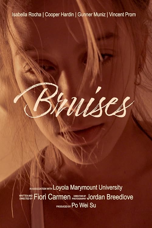 Bruises