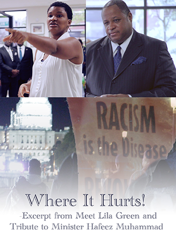 Where It Hurts!