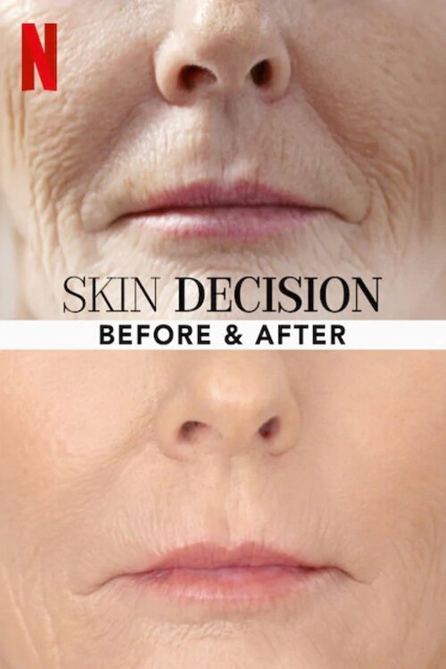 Skin Decision: Before and After