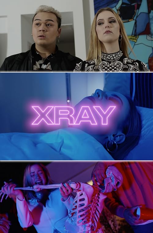 X-Ray