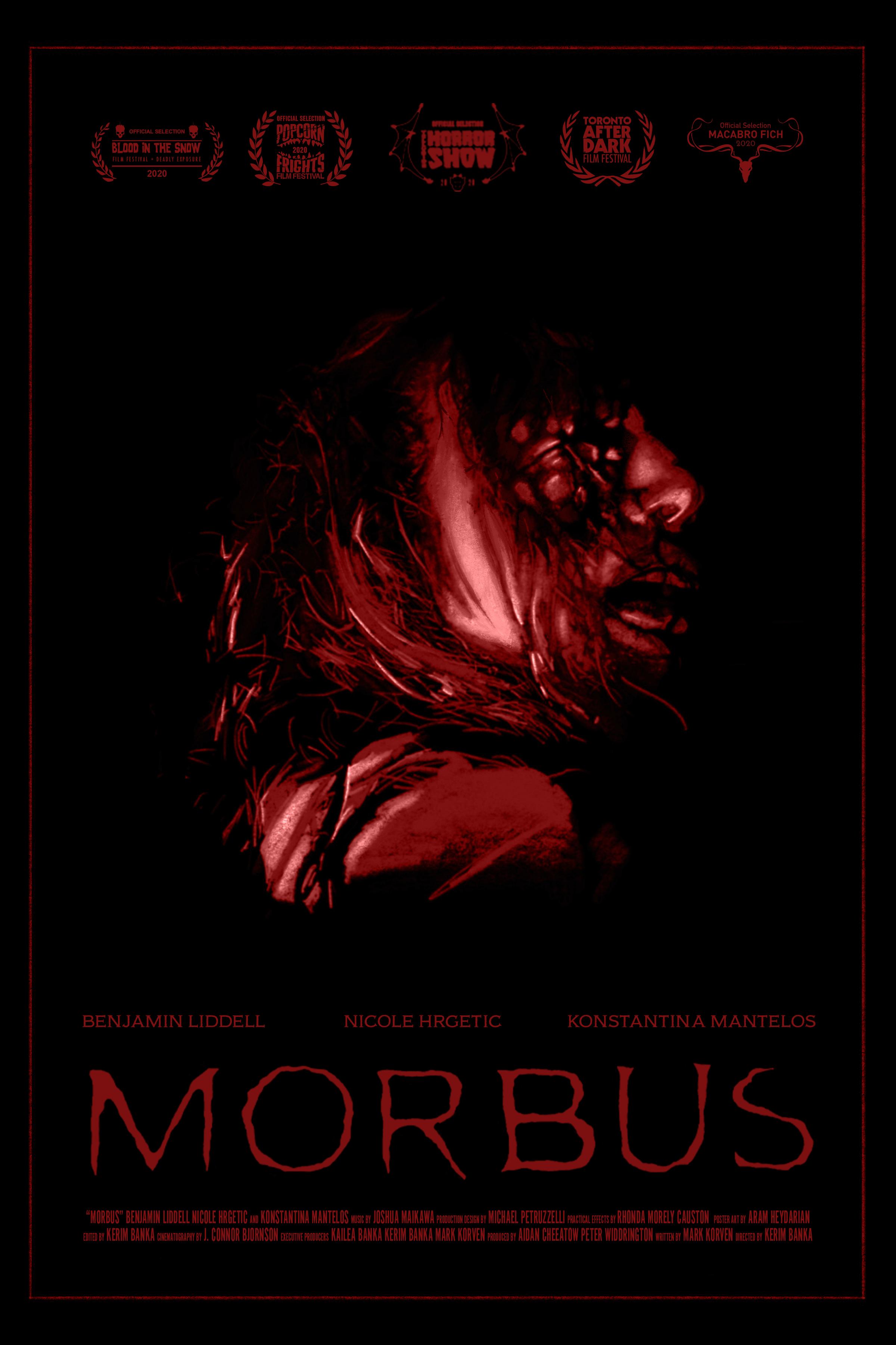 Morbus