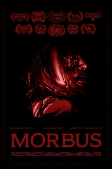 Morbus