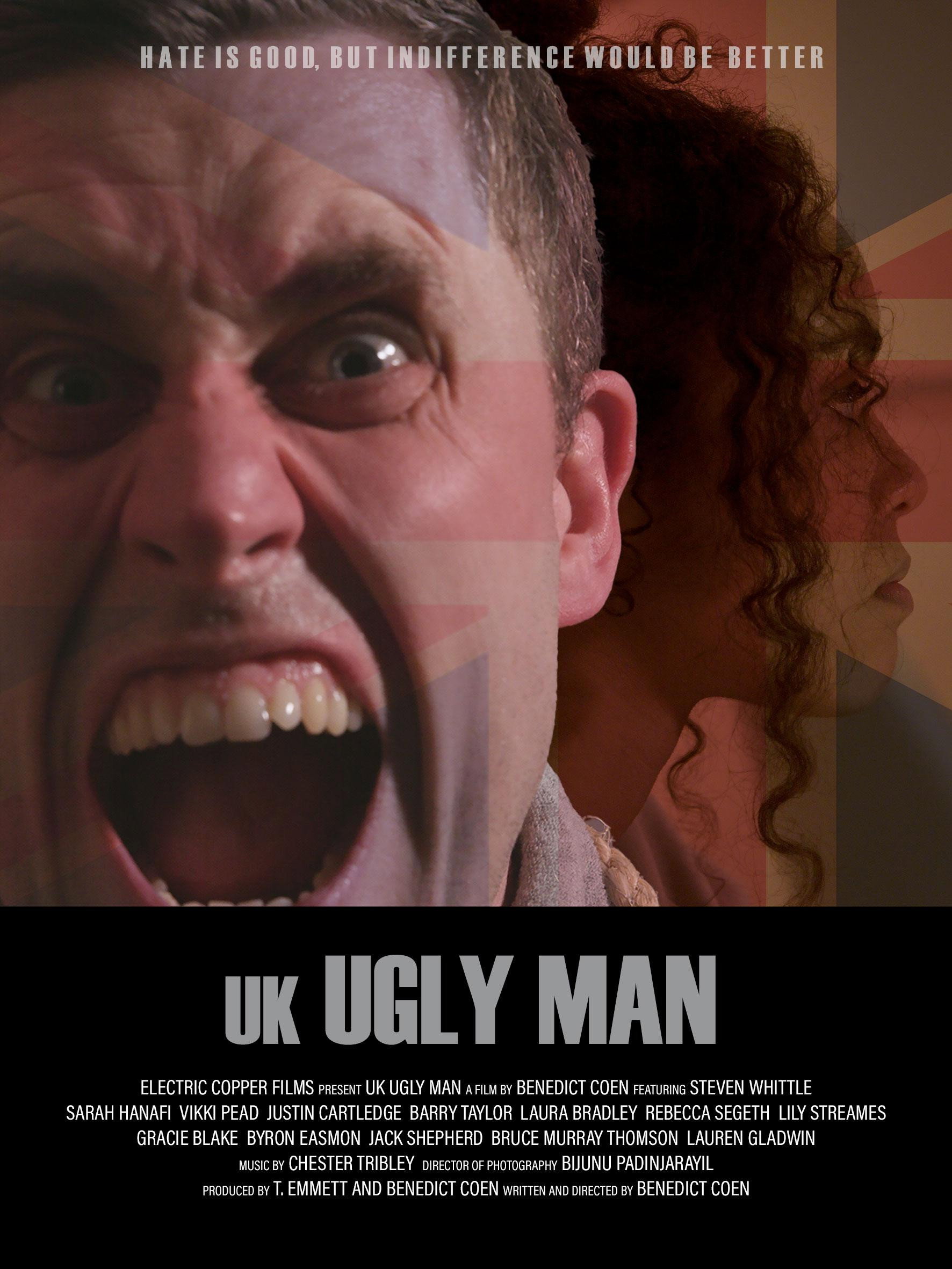 UK Ugly Man